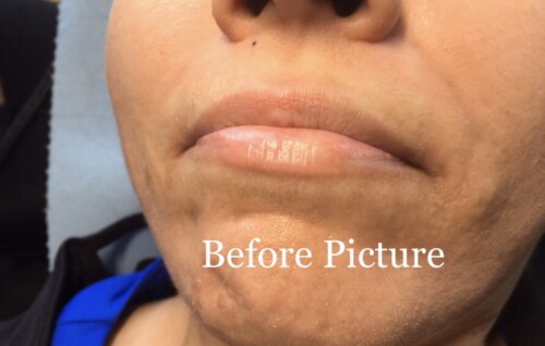 Permanent Makeup before Picture