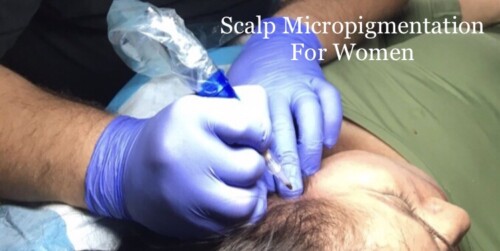 SCALP MICROPIGMENTATION PROCEDURE