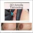 Areola Procedure