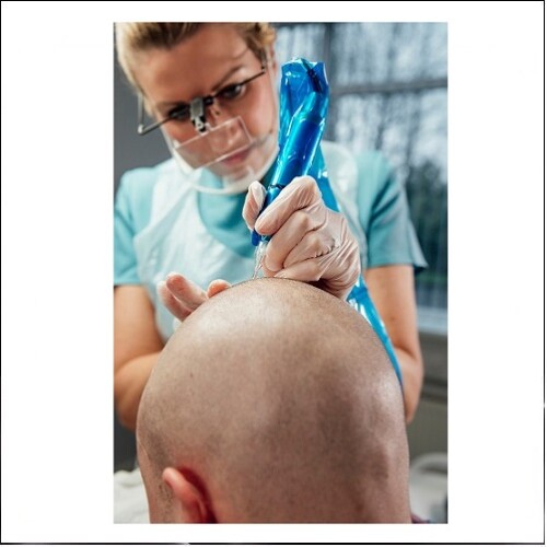 Scalp Micropigmentation Pigments